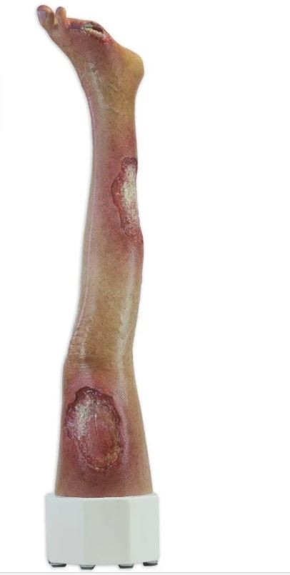 Künstliche Wunden 1